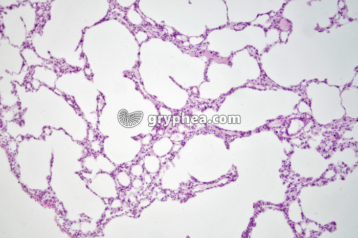 Poumon Rat x40 - gryphea.org